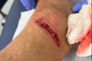 丹索：迪涅在場(chǎng)邊我向他道了歉，確實(shí)碰到了他，但我明顯先清了球